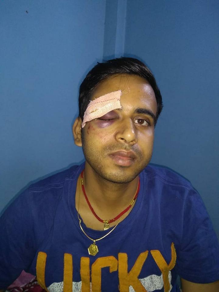Manish Kumar, Train Operator of Delhi Metro Rail Corporation who was beaten by some outsiders near Kalindi Kunj Metro Depot.